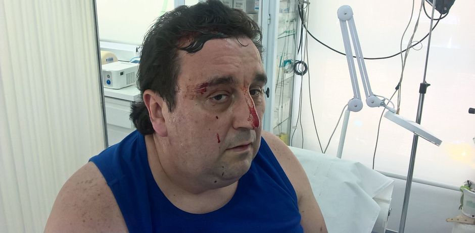 Trabajador agredido en la huelga de restauracin de los Ministerios de Economa y Defensa